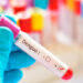 Métodos de laboratorio para diagnóstico de dengue